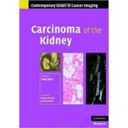 Carcinoma of the Kidney - Uday Patel