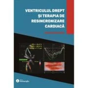 Ventriculul drept si terapia de resincronizare cardiaca - Silvia Deaconu